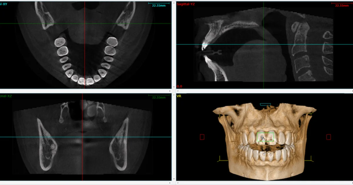 Embracing Advanced Dental Care with CBCT Technology at Cville Dentist
