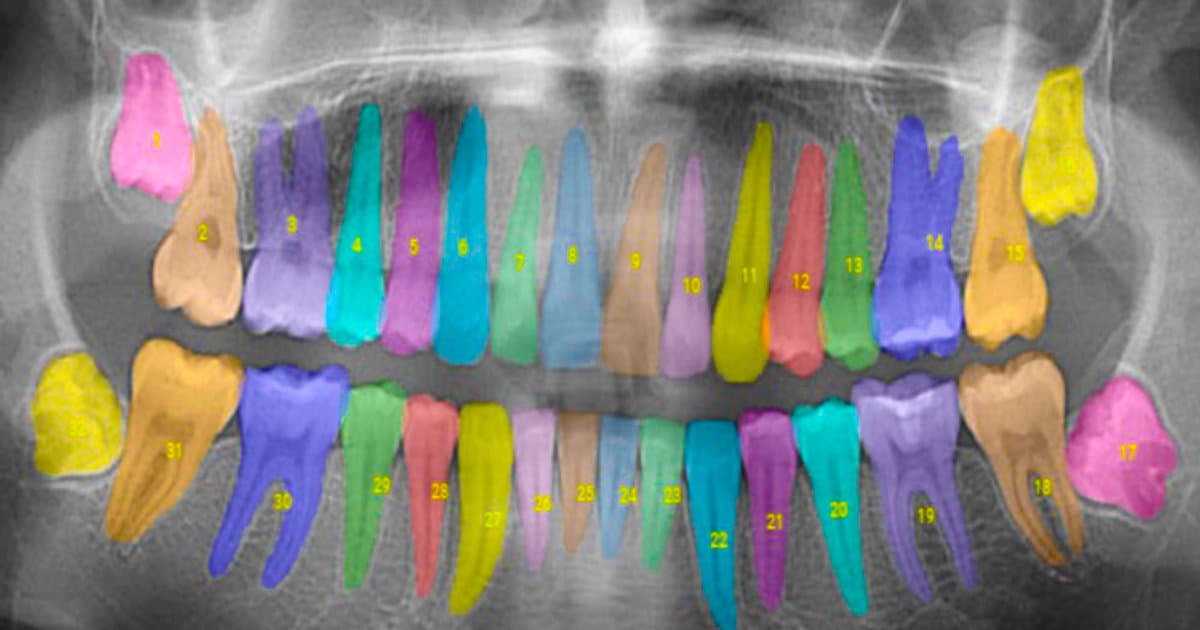Leading the Way in AI Dentistry: Our Transformative Experience with the Apteryx AI Diagnosing Tool